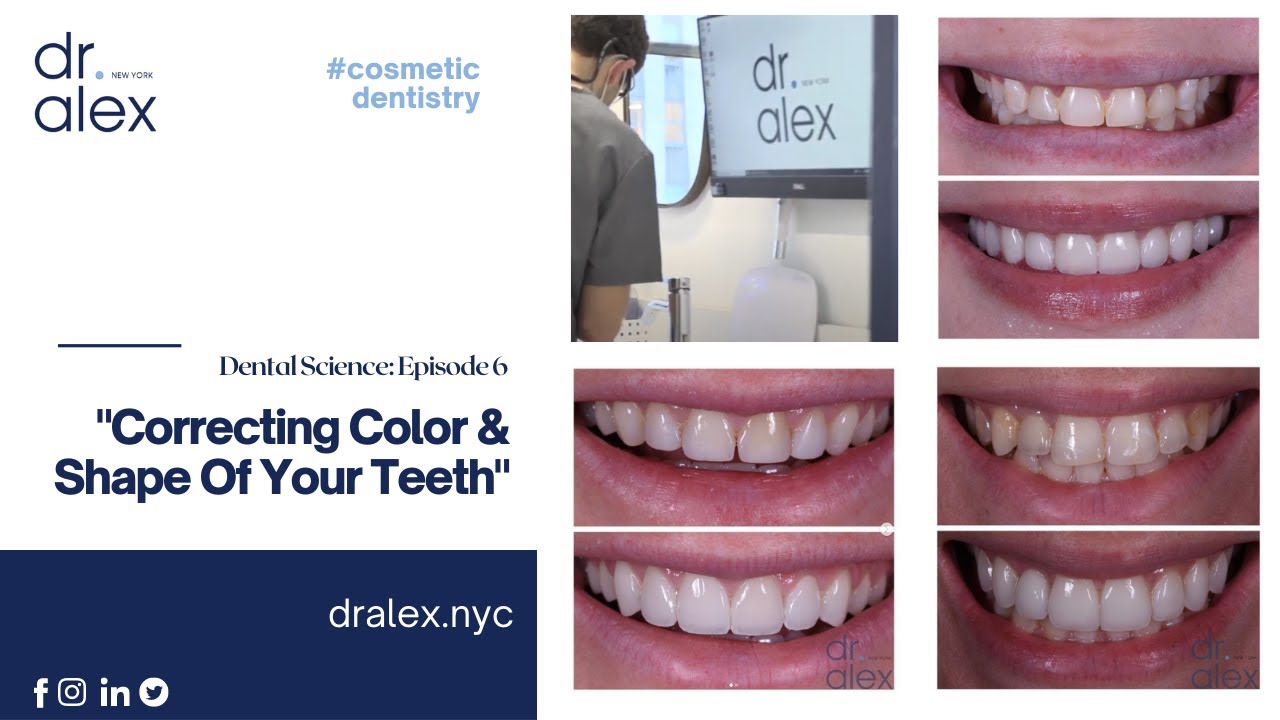 Correcting Color & Shape Of Teeth Dental Science - Dental Science ...