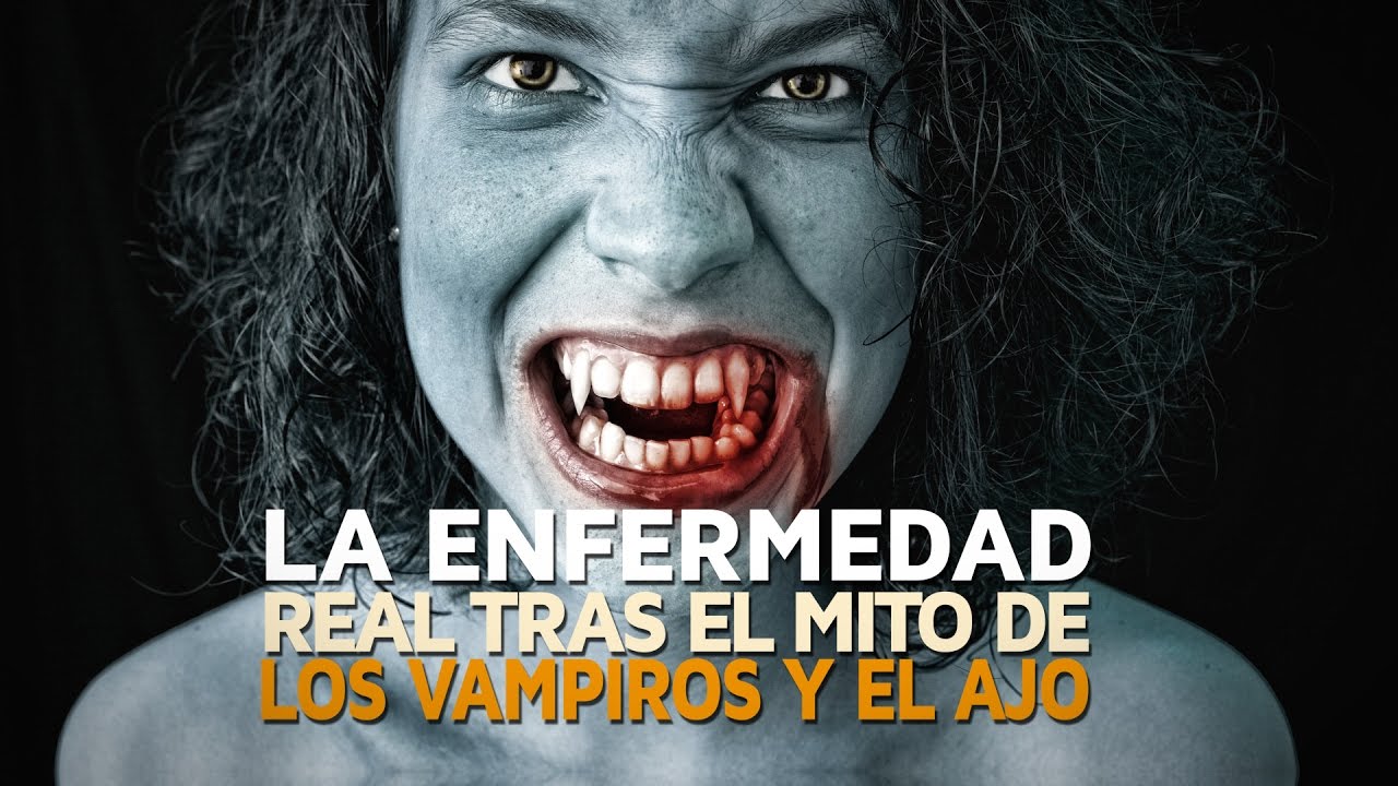 Image result for porfiria vampiros