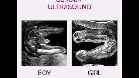 BOY | Gender Scan of 32 weeks old baby boy