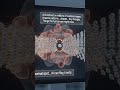 AI In Cancer Detection #science