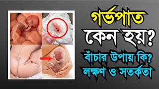 Miscarriage বা গর্ভপাতের লক্ষণ কারন ও প্রতিকার কি?|গর্ভপাত প্রতিরোধের উপায়|Symptoms of Miscarriage.