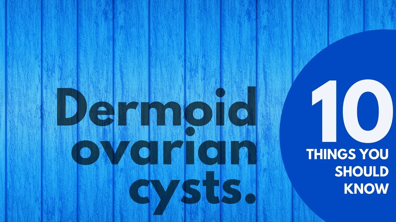 10 Things You SHOULD KNOW About Dermoid Ovarian Cysts | Prevent & Treat
