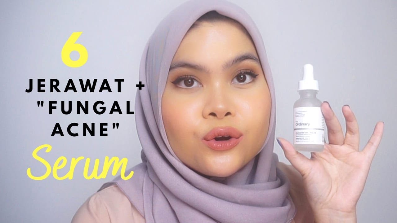 Skincare Fungal Acne 6 Serum Bagus Andalan Youtube