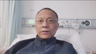 Wuhan Doctor Who Suffers Pigmentation from COVID-19 Recovering