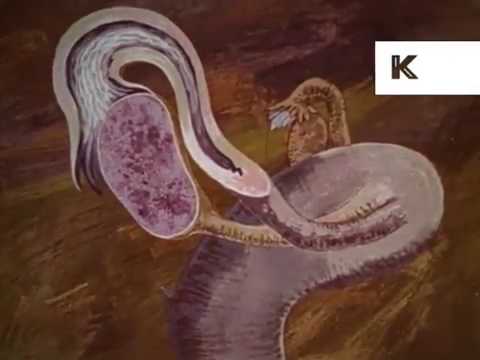 1960s Sex Education Film, Puberty, Period, USA