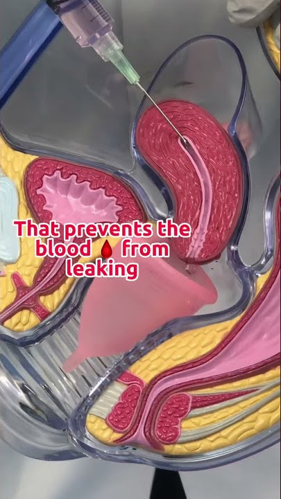 🤷🏻‍♀️🩸Menstrual cups & how they work #menstrualcup #periods #gynecologist #obgyn #menstrualcups