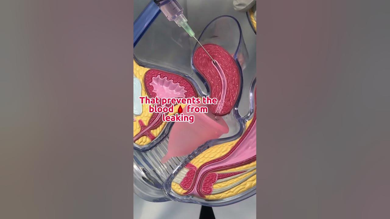 🤷🏻‍♀️🩸Menstrual cups & how they work #menstrualcup #periods #gynecologist #obgyn #menstrualcups