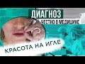 Пластические операции: о чём умалчивают косметологи? | Диагноз