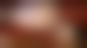 Cholangiogram ONLY during daVinci Robotic Single Site Cholecystectomy