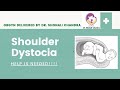 Shoulder Dystocia : Risk Factors and Management : Dr. Shonali Chandra #NEETPG, #AIIMSPG, #DNB