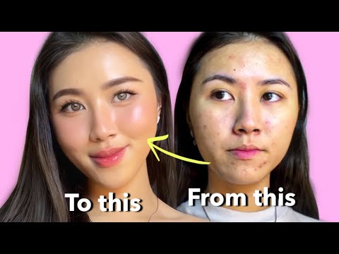 Video: Cara Mudah Menutup Parut Jerawat dengan Makeup (dengan Gambar)