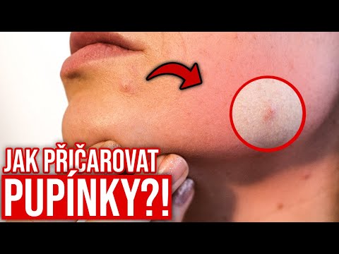 Video: Žitomirovi a Berdičevovi. Porážka kyjevského uskupení německé armády