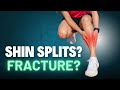 Do you have a Stress Fracture or Shin Splints? Foot or Shin Pain??