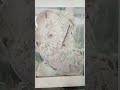 #RENAL CELL CARCINOMA (Gross specimen) pathology practical