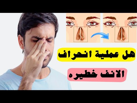 هل عملية انحراف الانف خطيره