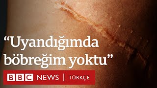 Organ Kaçakçılığı Uyandığımda Böbreğim Yoktu