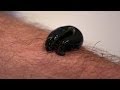 Michael mosley is bitten by a leech  infested living with parasites  bbc four