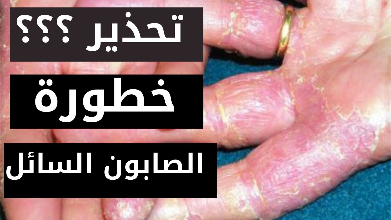 طريقة معادلة الصابون السائل باستخدام_PH_حتى لا تعرض يديك للخطر_هام وعاجل