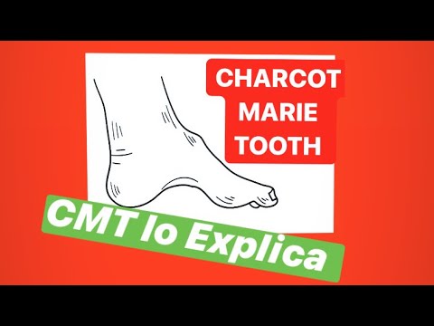 Vídeo: Proteína De Mielina Periférica 2: Un Nuevo Grupo De Mutaciones Que Causan Neuropatía De Charcot-Marie-Tooth