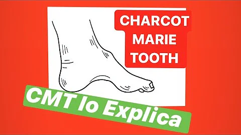 ¿Puede prevenirse la enfermedad de Charcot-Marie-Tooth?