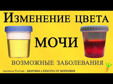 О ЧЕМ ПРЕДУПРЕЖДАЕТ ИЗМЕНЕННЫЙ ЦВЕТ МОЧИ