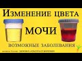 О ЧЕМ ПРЕДУПРЕЖДАЕТ ИЗМЕНЕННЫЙ ЦВЕТ МОЧИ