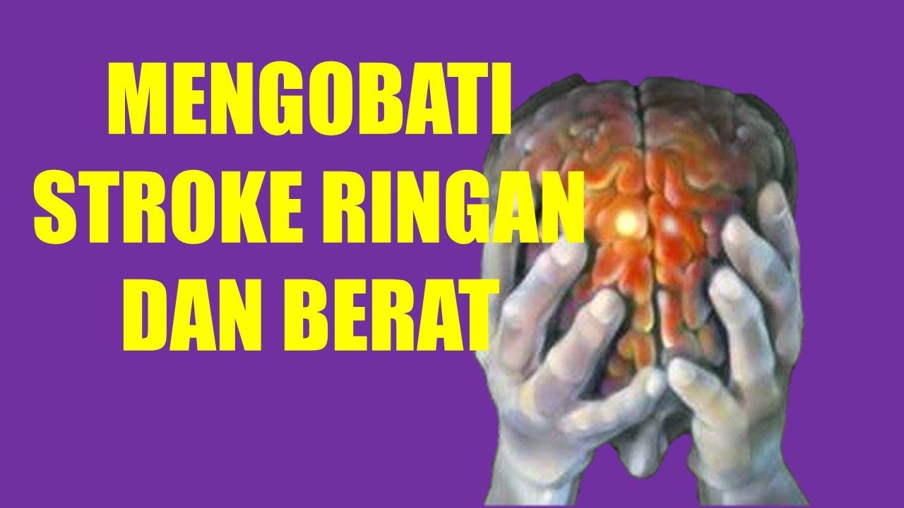 bagaimana mengobati stroke ringan obat stroke ringan obat herbal