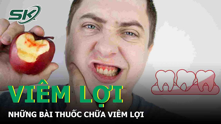 Thuốc chấm viêm lợi sindolor là gì năm 2024