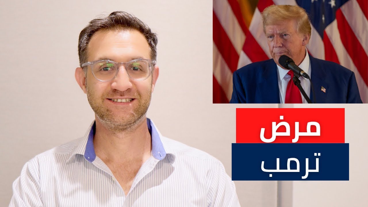 مرض دونالد ترمب | تورم الساقين | القصور الوريدي المزمن