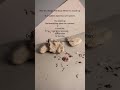 Feeling Dizzy When Standing? Watch This