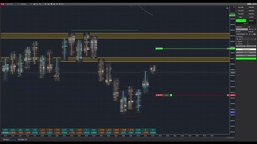 Euro Futures Session with an Automated Trading Interface