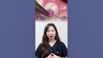 ĐEO CHUN MẮC CÀI SAI CÁCH MÀ CÓ THỂ BẠN CHƯA BIẾT? #shortvideo #shorts