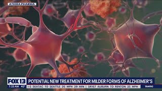 Potential new treatment for milder forms of Alzheimer's | FOX 13 Seattle