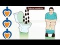 What to know about diarrhea?