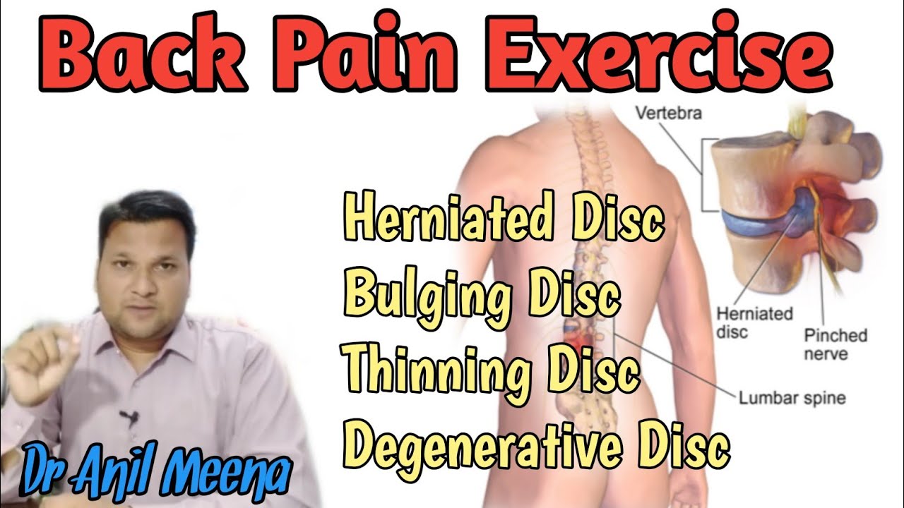 Back Pain Exercise Herniated Disc Exercise Bulging Disc Exercise