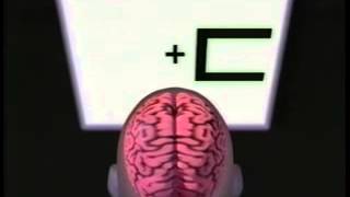 Famous Severed Corpus Callosumwmv Wealth