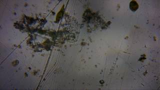 Capture 20170501 7 - amoeba