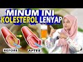 7 minuman enak ampuh menurunkan kolesterol secara alami tanpa obat dokter wsp