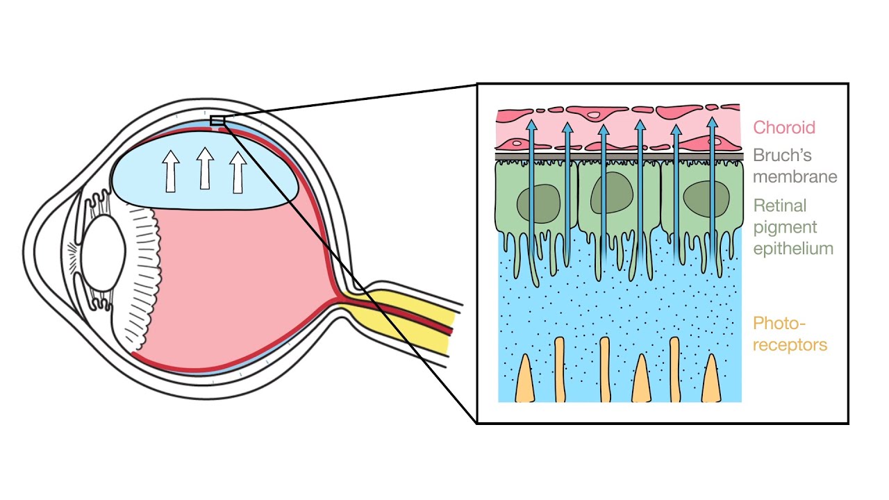 Mechanism of Retinal Reattachment Following Pneumatic Retinopexy YouTube