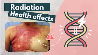 Side effects of Radiation | Deterministic vs. Stochastic effects