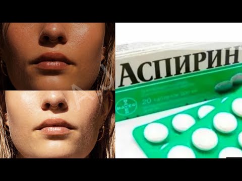 Отбеливающая маска для лица с аспирином | Как отбелить лицо дома