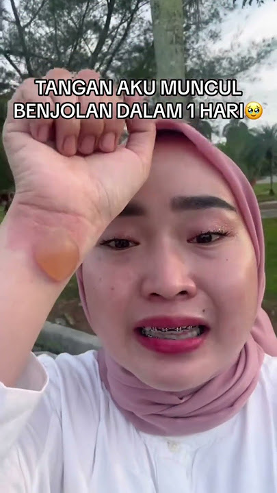 Tanganku Muncul Benjolan Besar !!?? katanya ada c4c1ngnya🙀