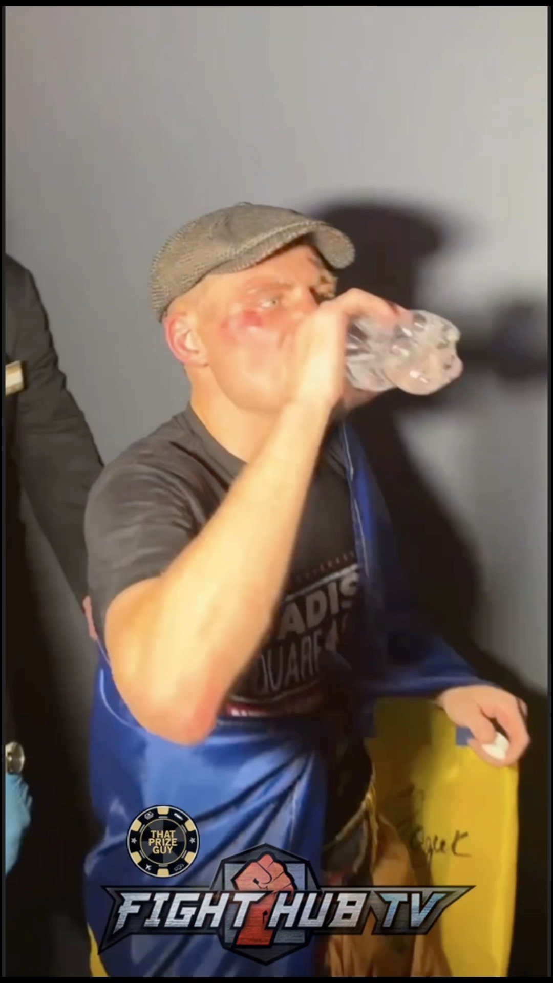 Bruised up Denys Berinchyk after KO loss to Keyshawn Davis!