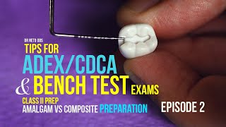 AMALGAM vs COMPOSITE Preparation - Part 2 - #adex #cdca #benchtest