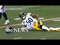 Steelers linebacker suffers major back injury