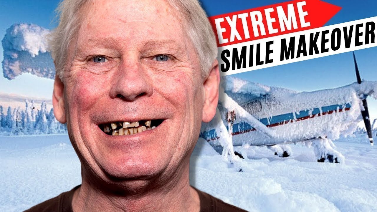 How I Traveled 2000 Miles For Dental Implants