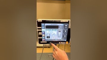 Ev1000 flotrac, minimally invasive (acumen sensor) setup
