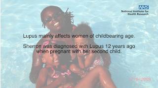 Download lagu Working together to BEAT lupus Working together to BEAT lupus