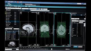 Brain MRI Technique خطوات عمل الرنين المغناطيسي علي المخ screenshot 5