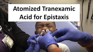 Atomized Tranexamic Acid for Epistaxis Control